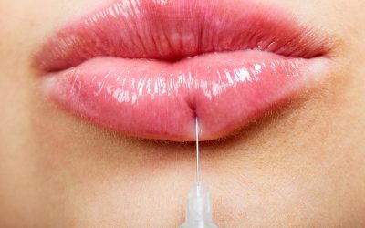 Botox for Fine Lines and Wrinkles: Refresh Your Look, Subtly